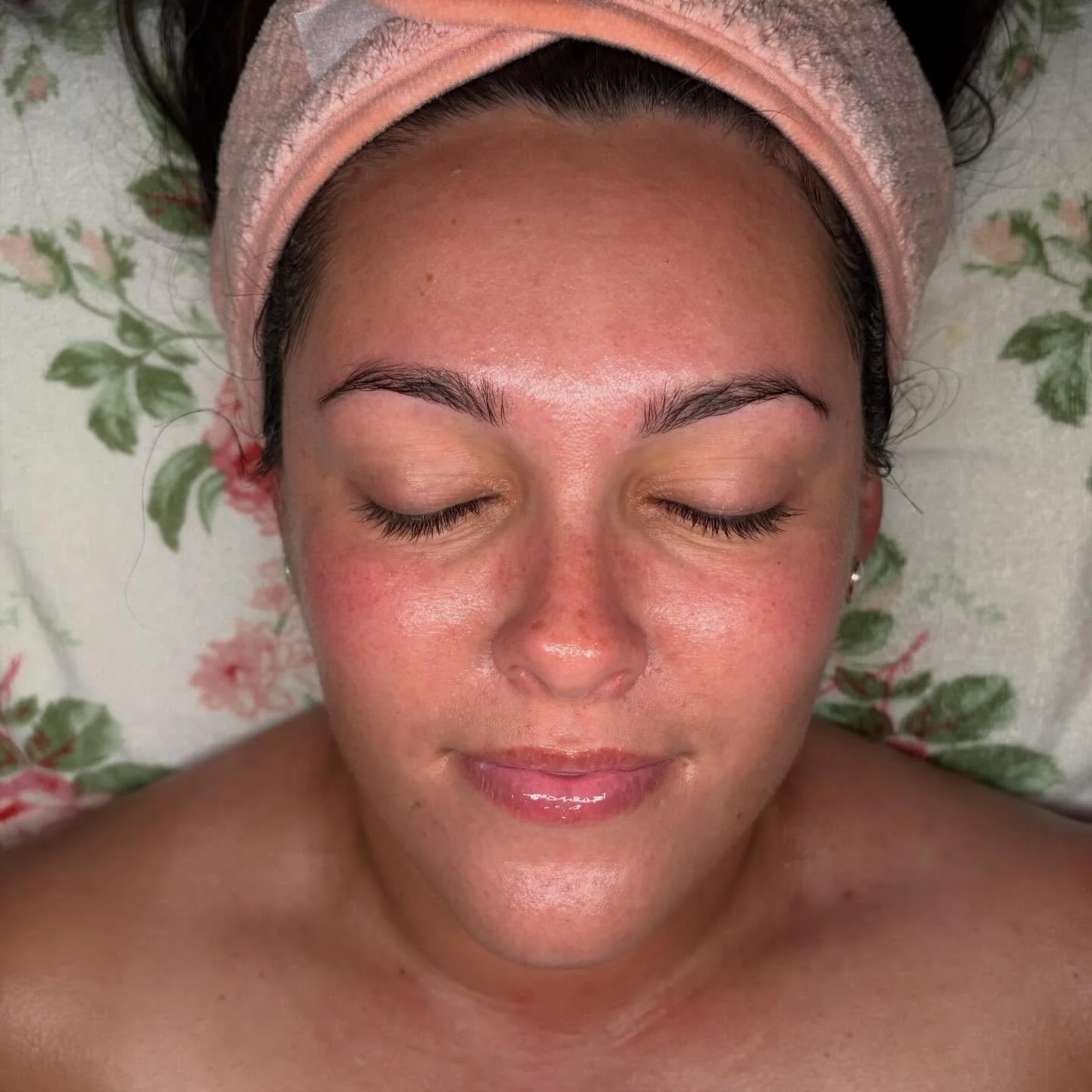 After 1 treatment focused on gentle exfoliation, hydration, and barrier support, the skin appears smoother, brighter, and more radiant 🫶🏼 

#pittsburgh #esthetician #facial #hydration