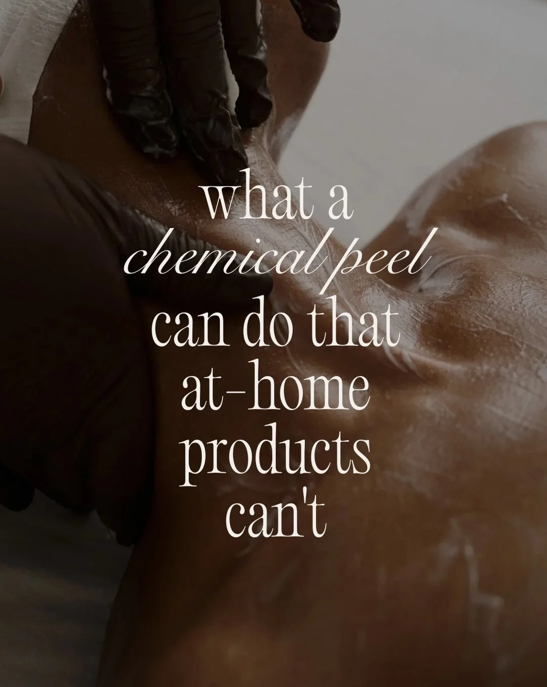 It&rsquo;s officially peel season!!!! 🍂

If texture, breakouts, congestion or uneven tone are your concerns right now then this is the time to get a little more intentional with your treatments.

Professional peels = targeted, customized exfoliation