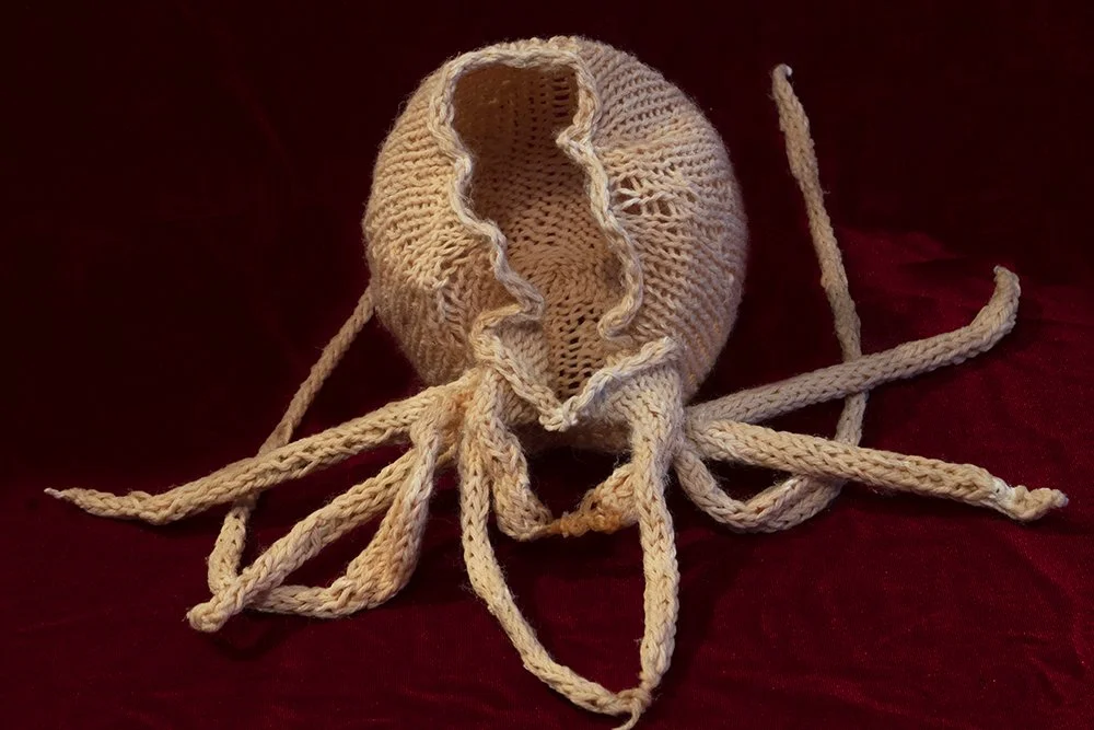 Da Vinci's Uterus