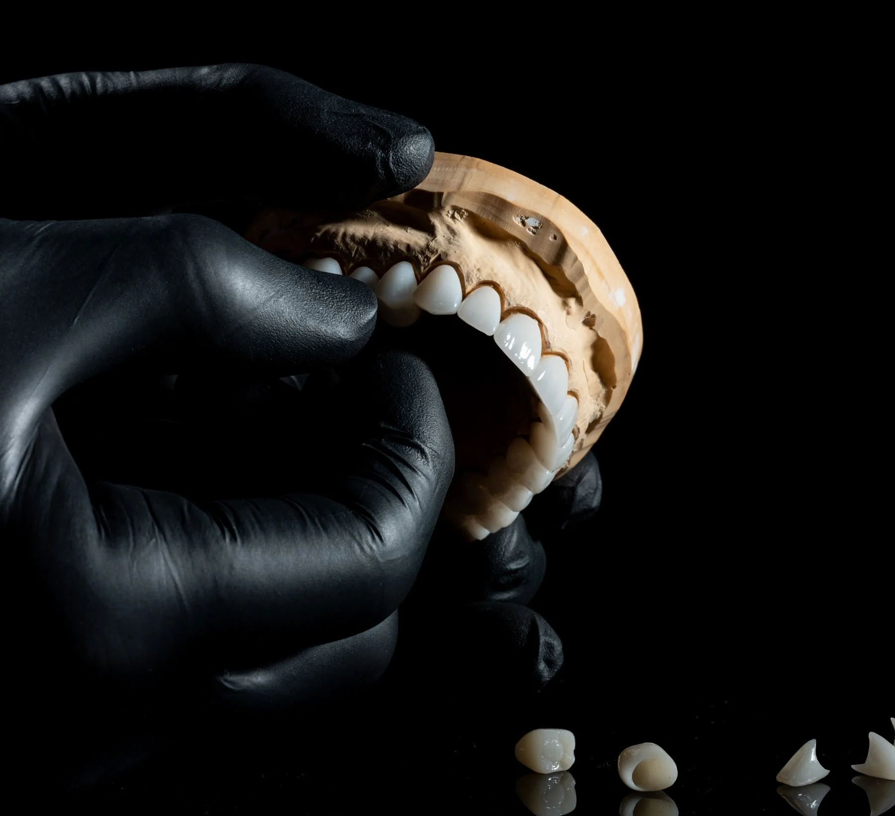 A person wearing black gloves holding a dental model of the upper teeth with some teeth placed on a black surface beside it.