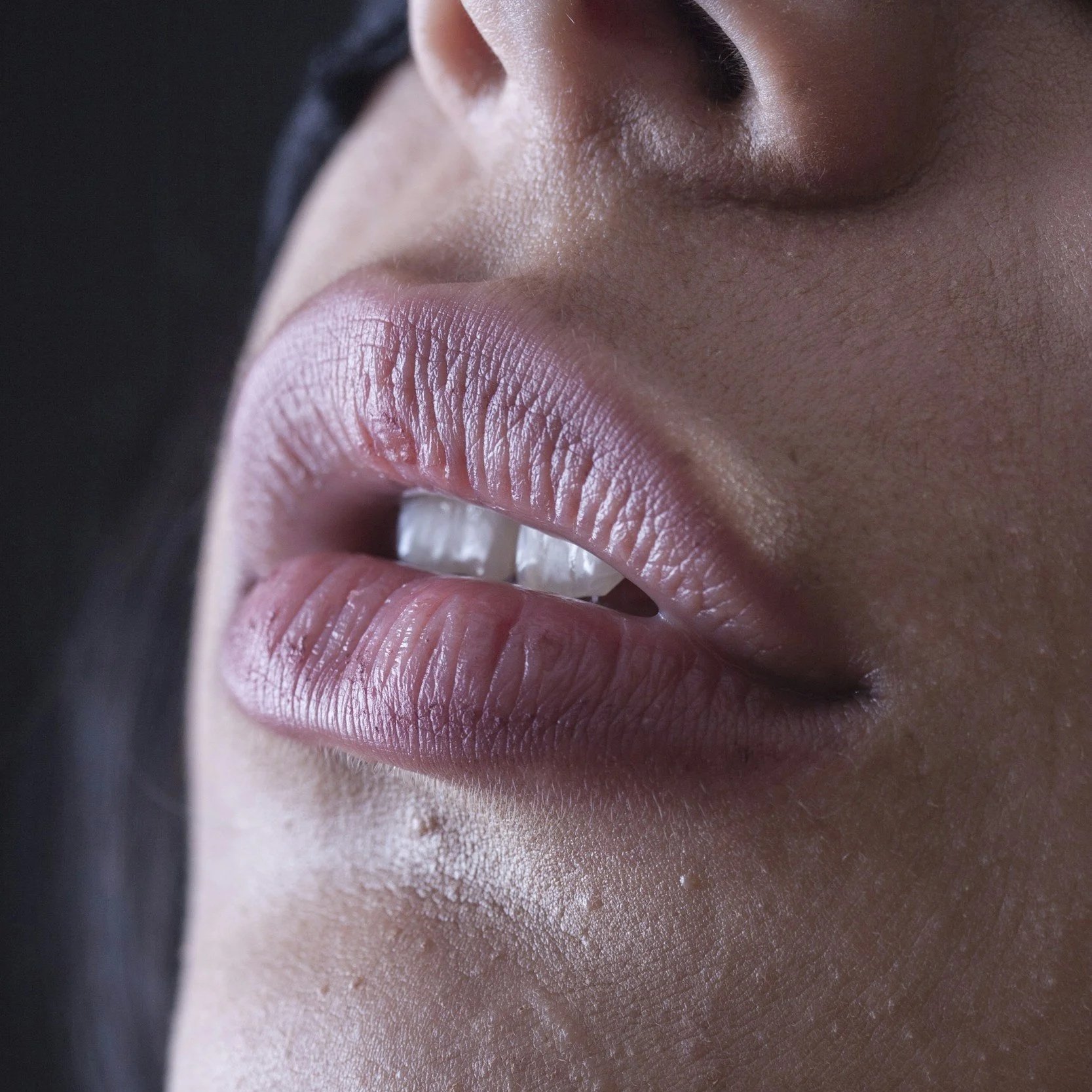 Chin + Lip Wax-30 Min-$45