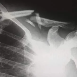 RT-radiographers’ role in the healthcare sector