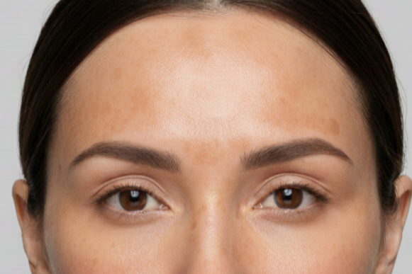 Dark Spots &amp; Uneven Tone