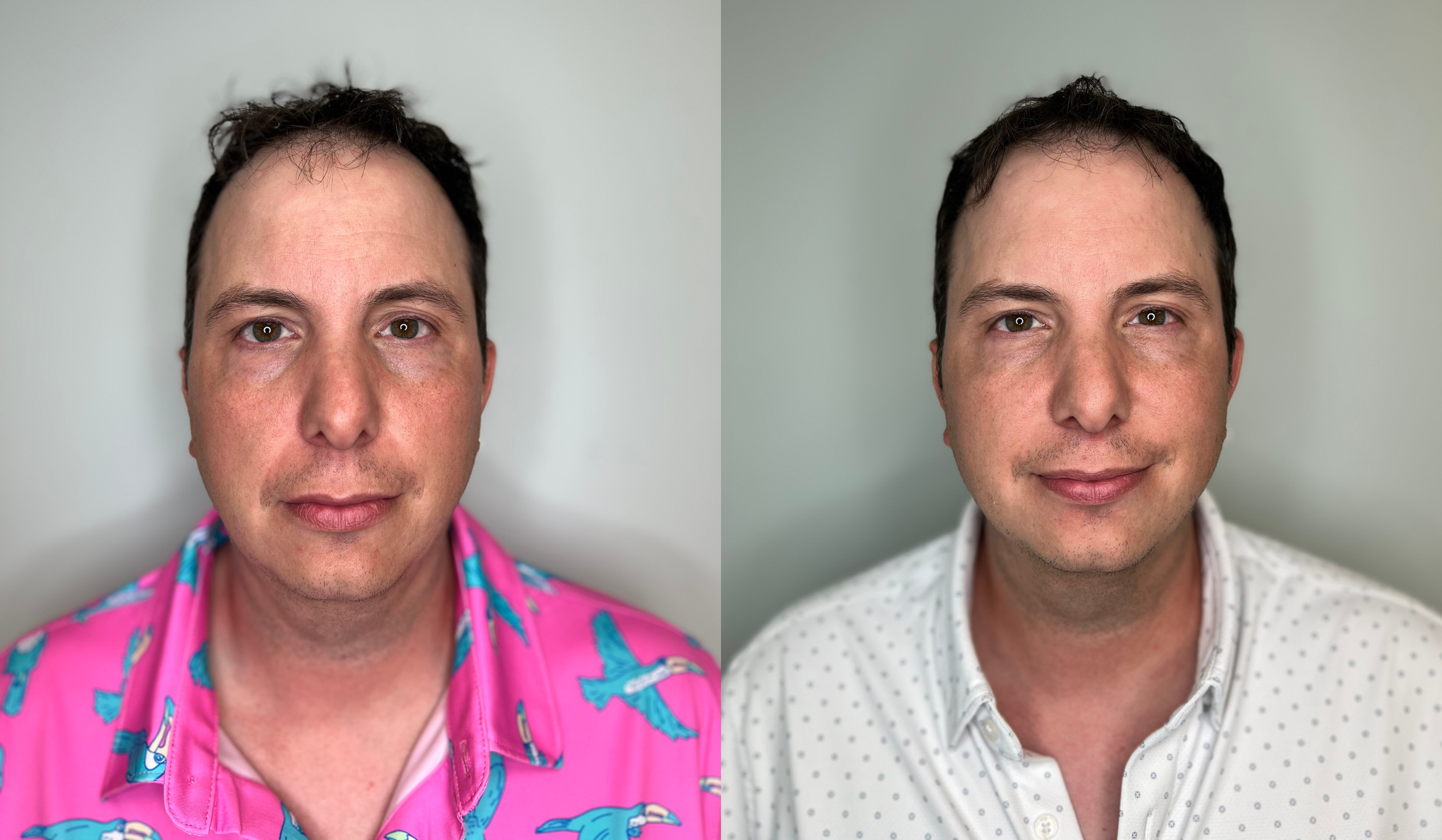 A side-by-side comparison of a man's face with and without makeup, wearing different shirts, in front of a plain light background.