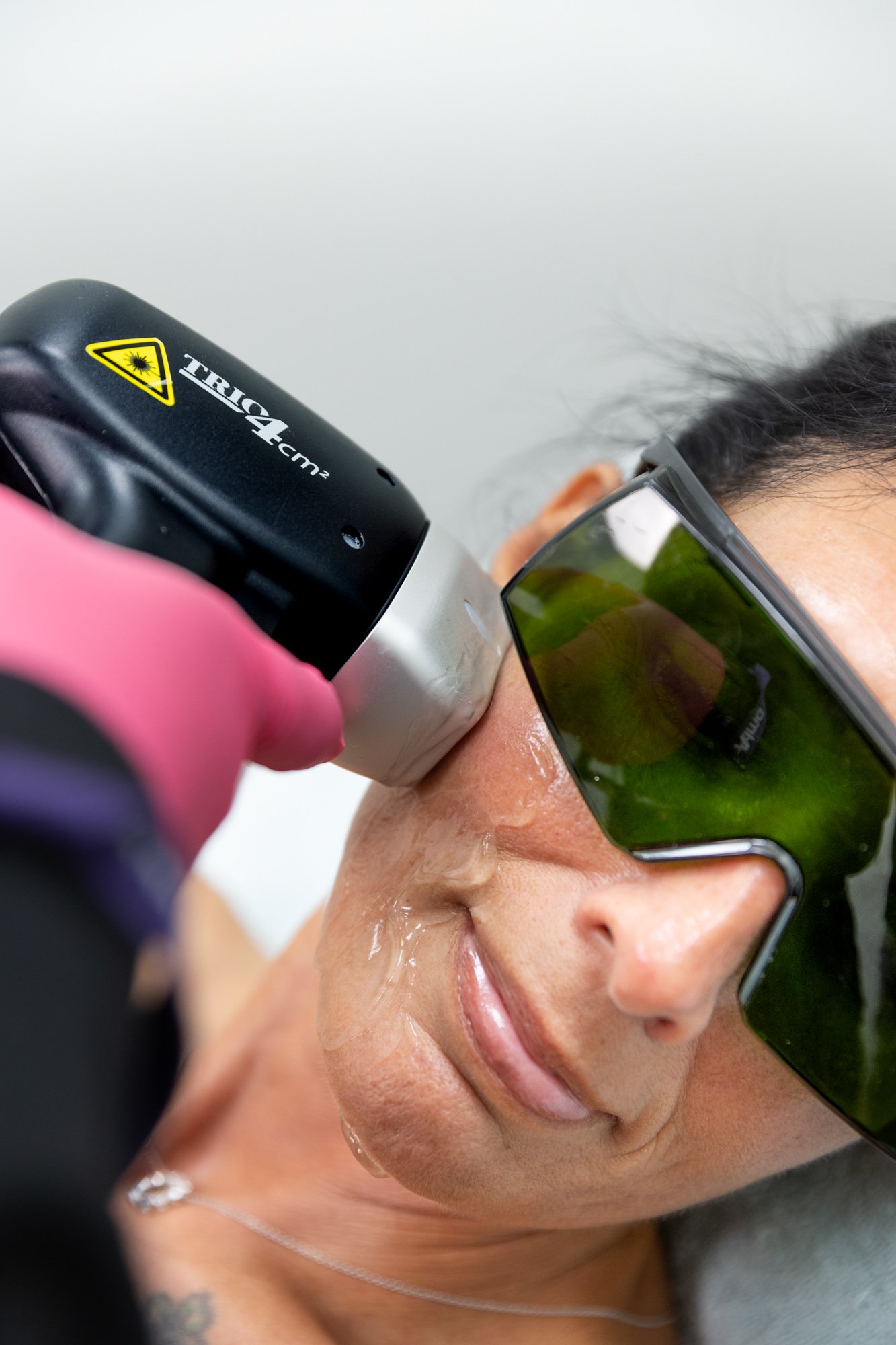 Goodbye Ingrown Hairs: Your Guide to Laser Hair Removal