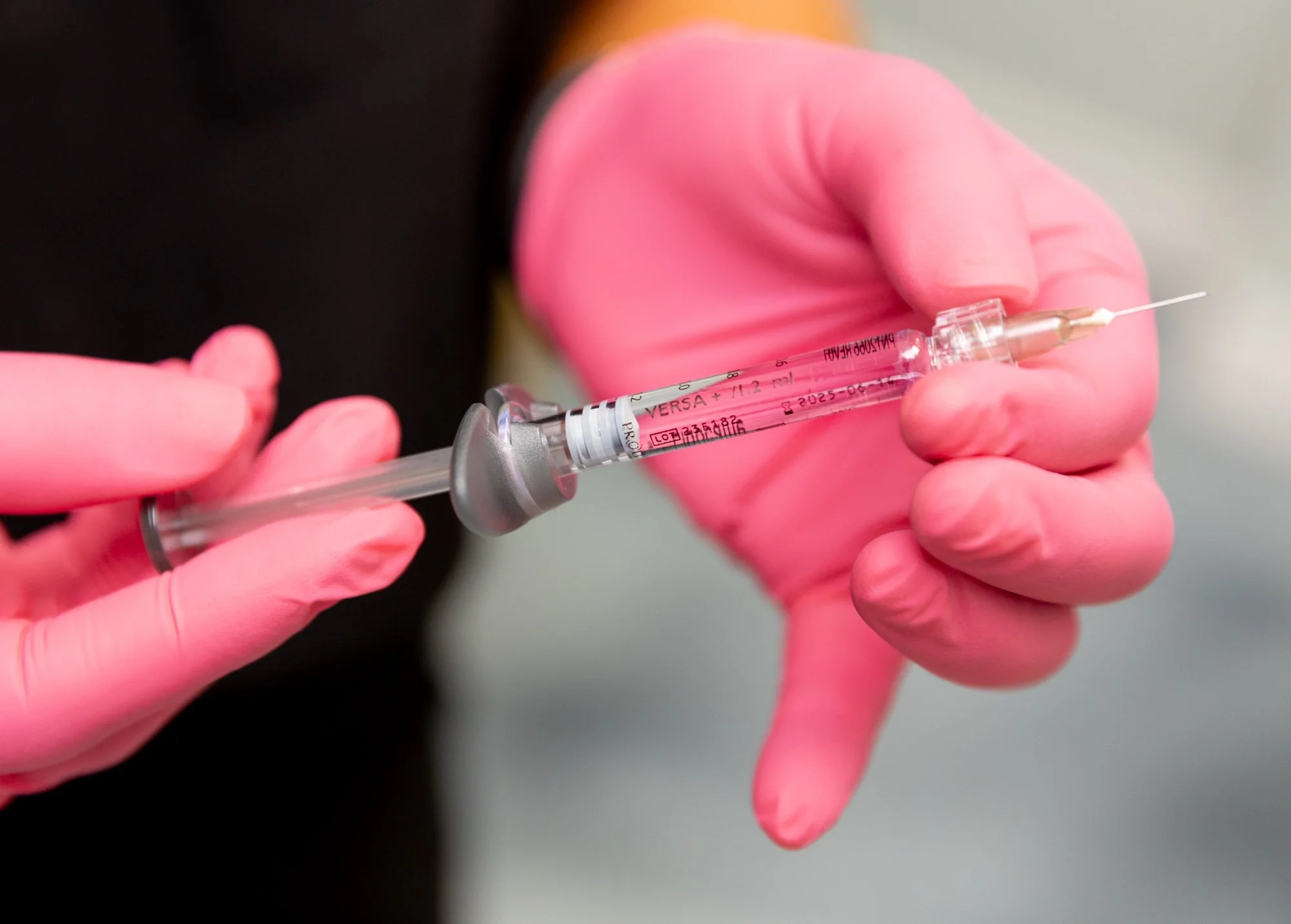 4 Things to Know Before Getting Dermal Fillers