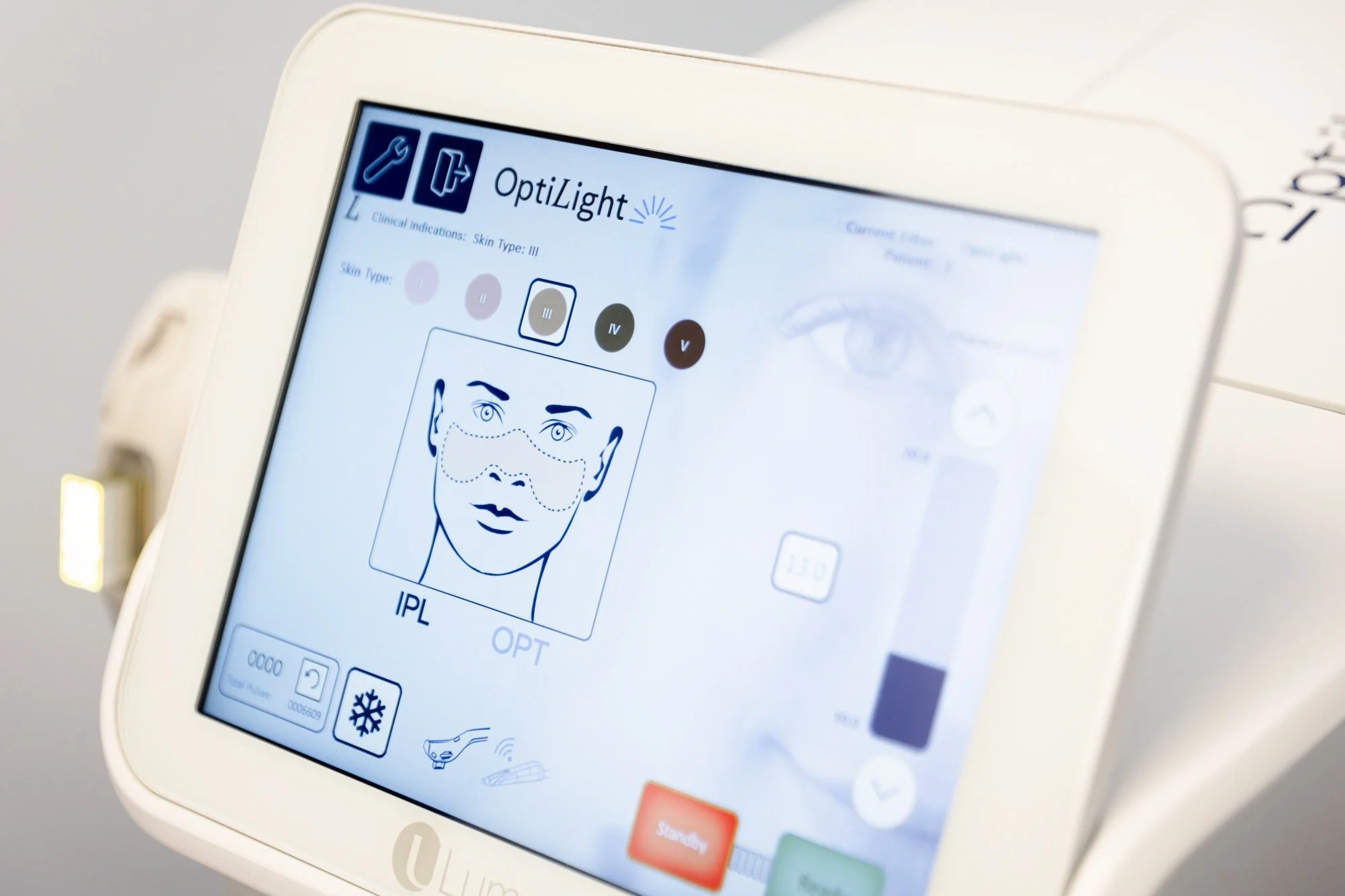 From Sun Damage to Smooth Skin: IPL Therapy Explained