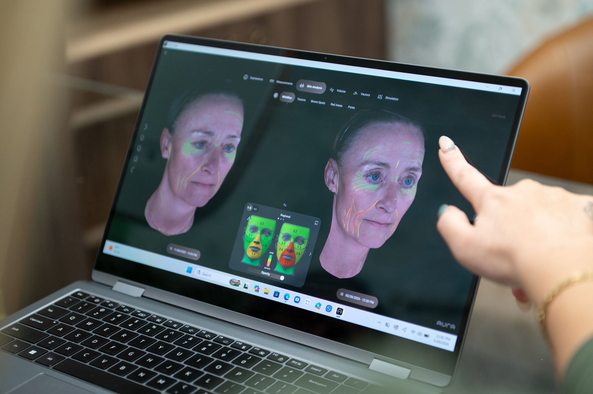 Botox Is Only One Piece of the Puzzle: Why We Take a Comprehensive Approach to Facial Aging