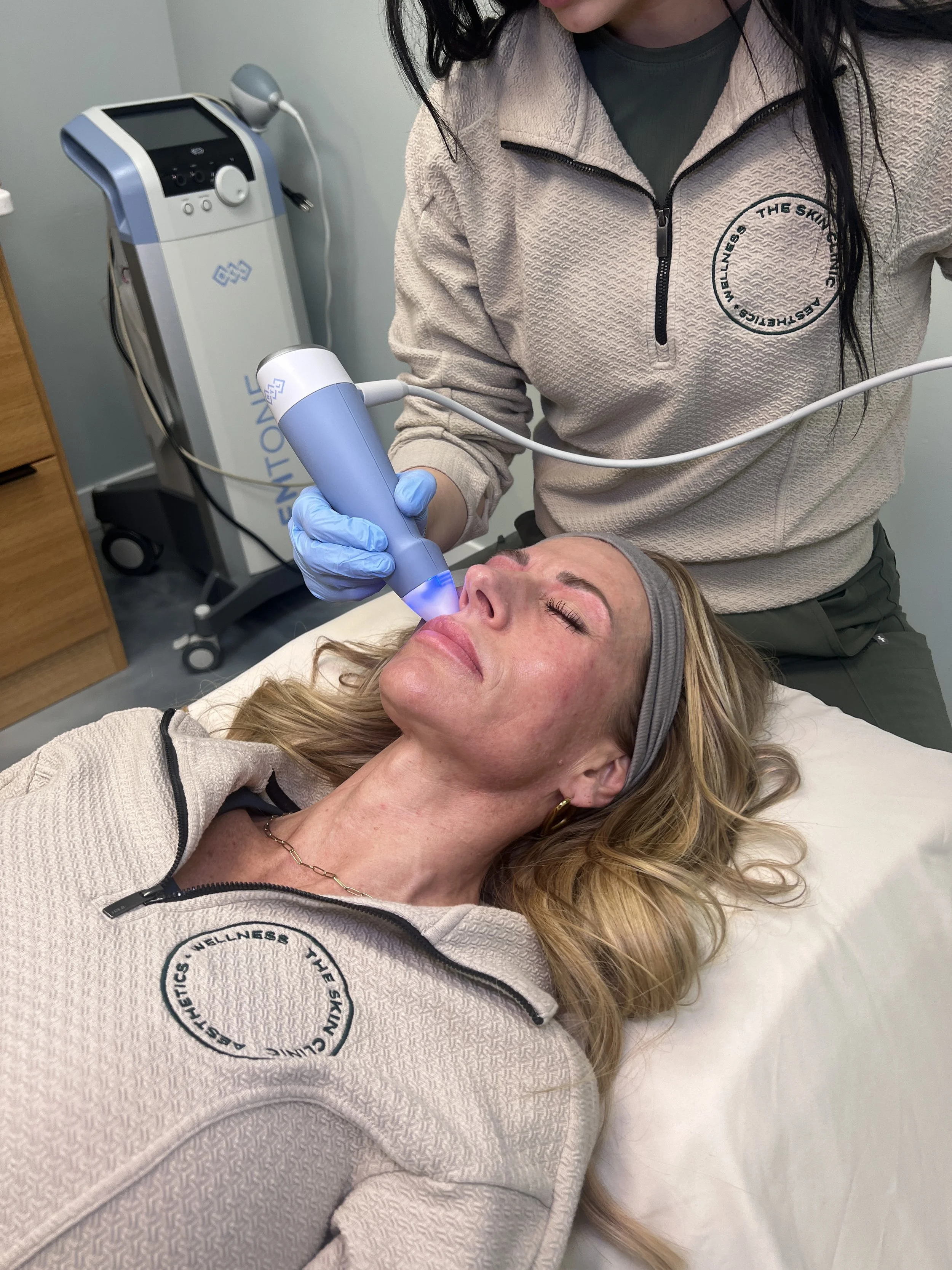CO2 Laser vs. Exion: Finding Your Best Skin Rejuvenation Treatment