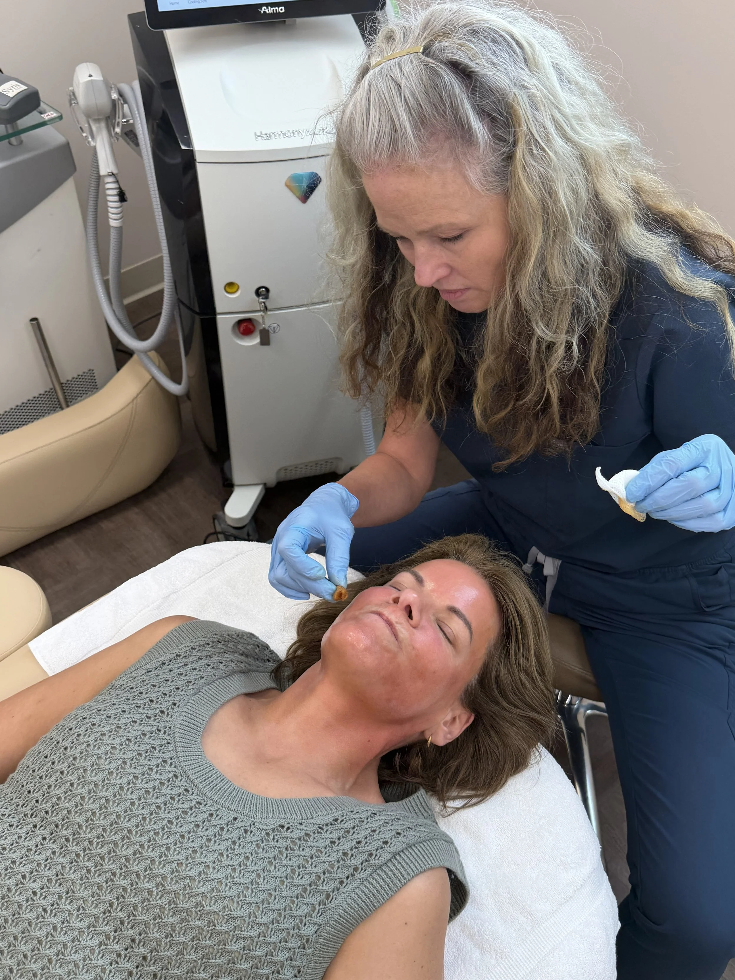VI Peel: Benefits, Side effects, and What to Expect from This Chemical Peel