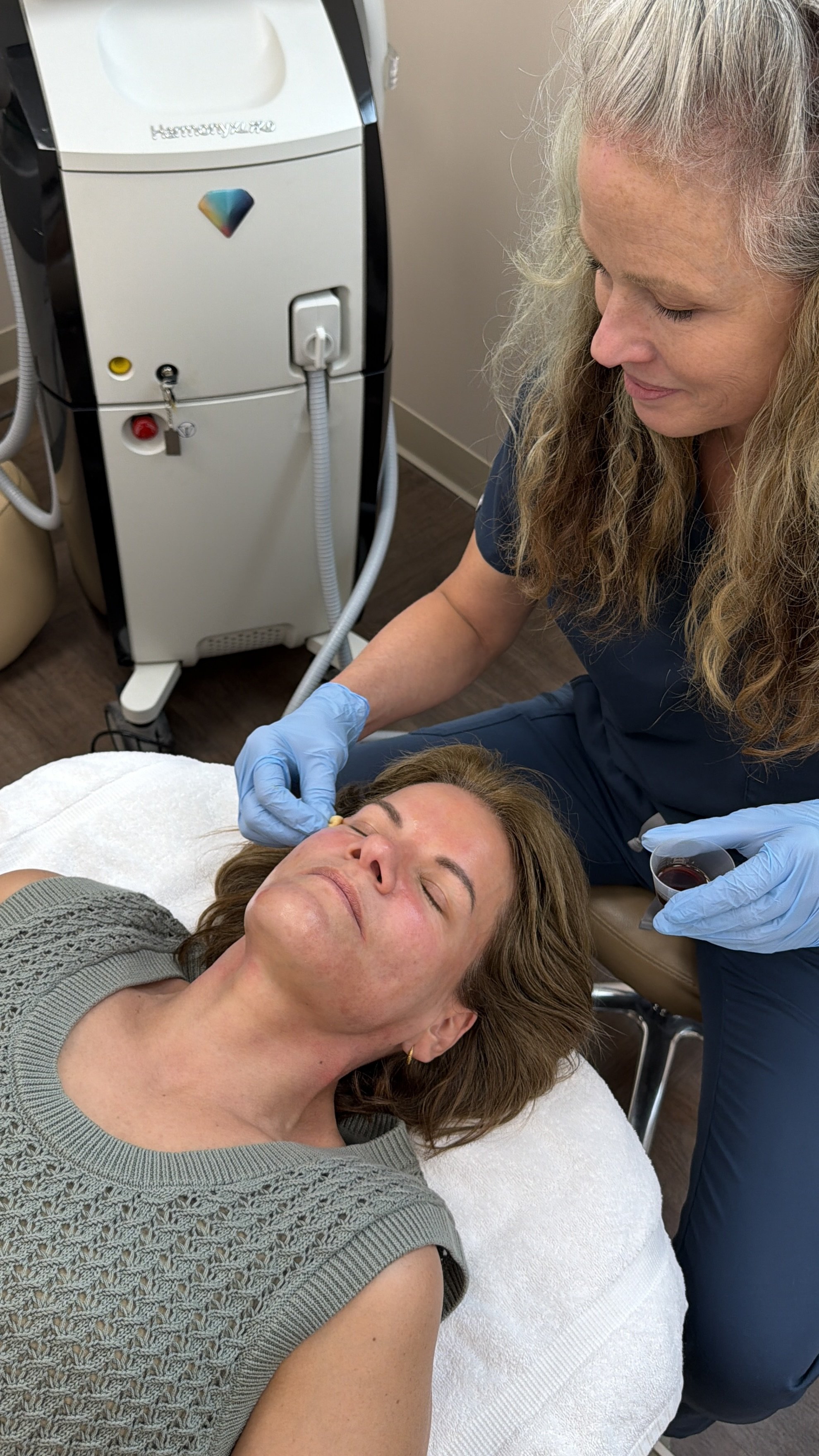 VI Peel: Benefits, Process, and Results for Skin Rejuvenation