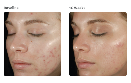 Screenshot 2025-12-15 165110.png