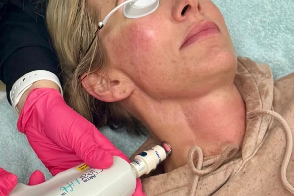A woman receiving a facial treatment using a cooling device on her face while lying on a treatment bed in a spa or clinic room.