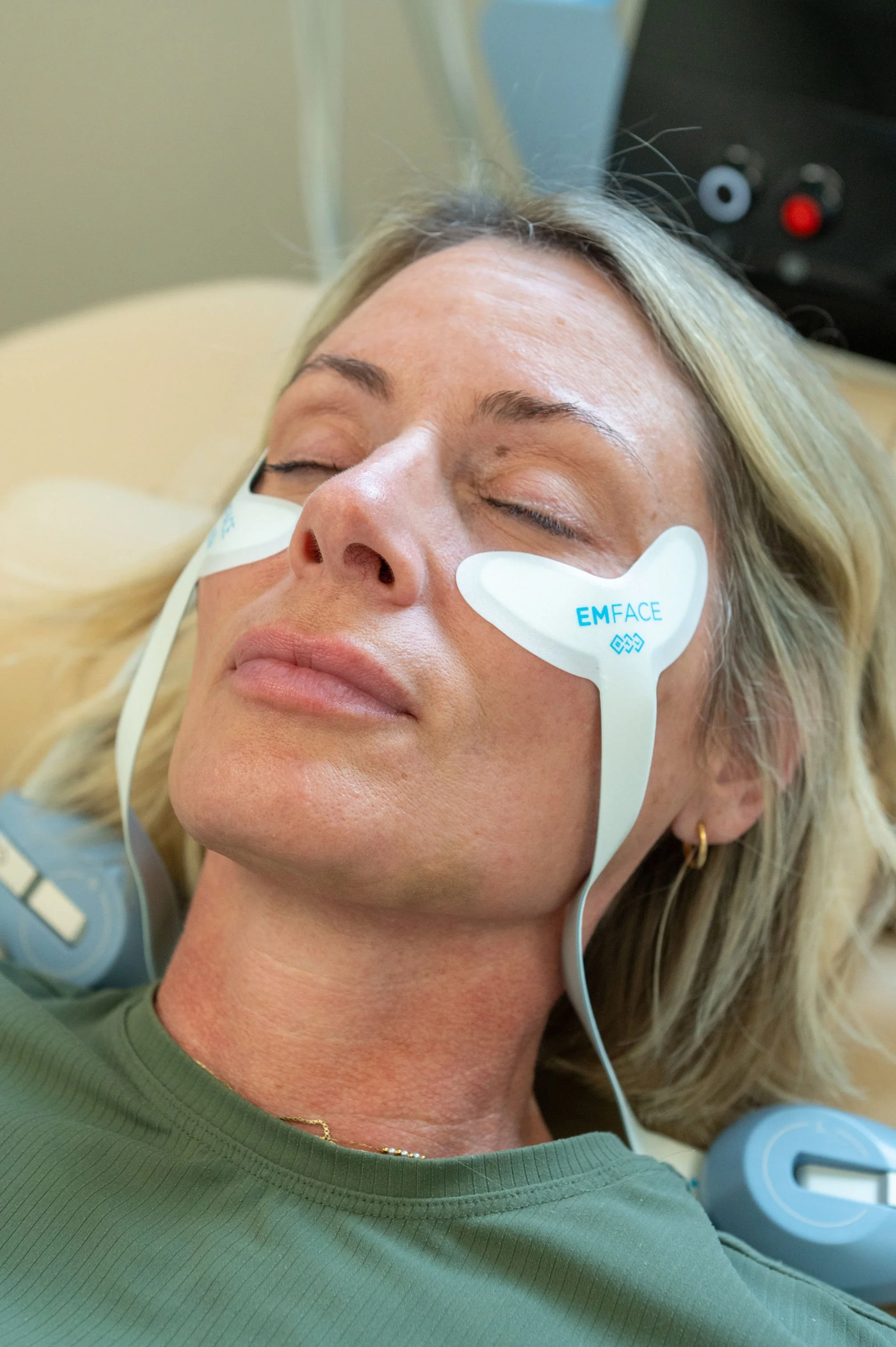 Emface Eye Treatment for EYe bags, wrinkles, mankato, Mn