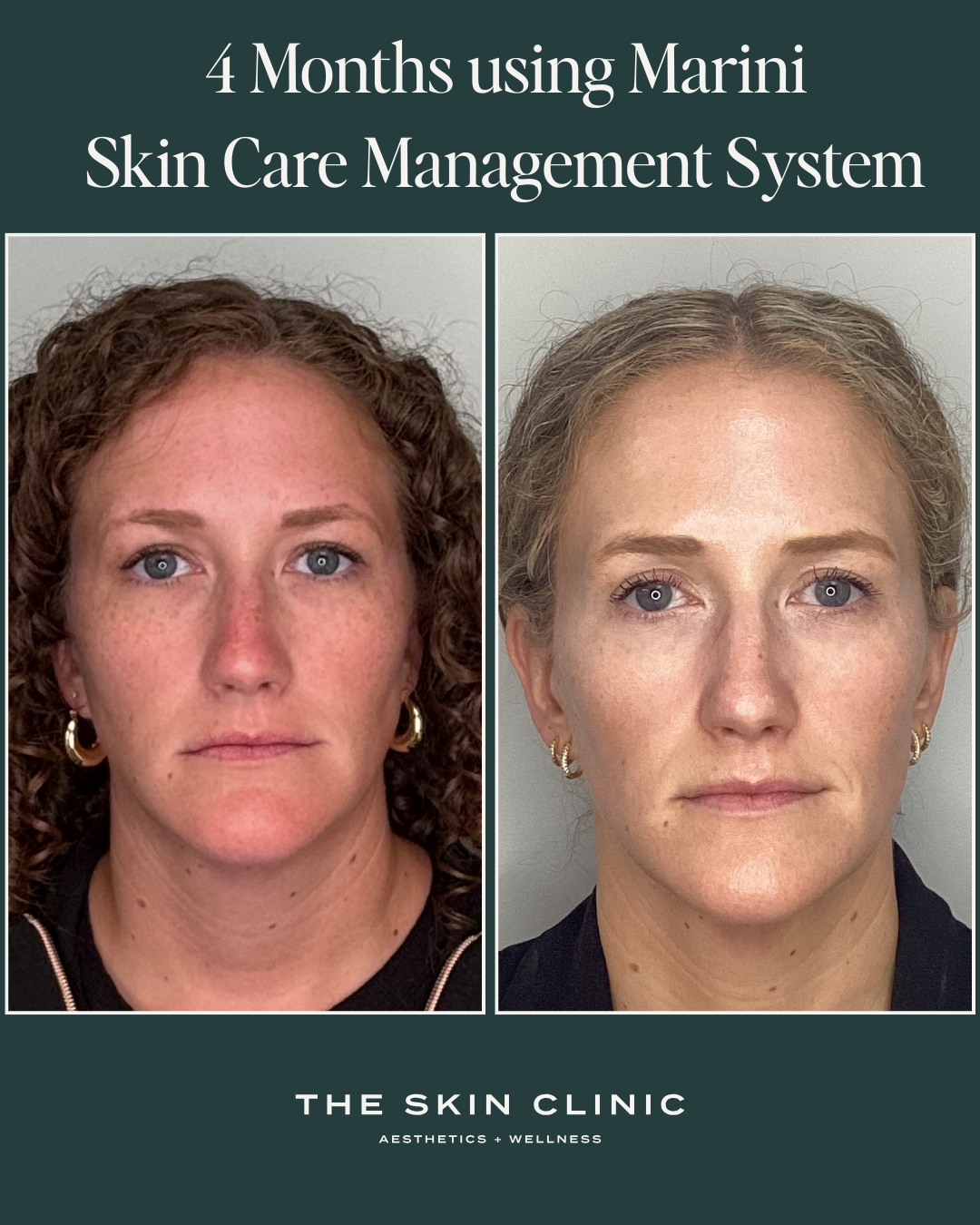 Skin Care Before and After 