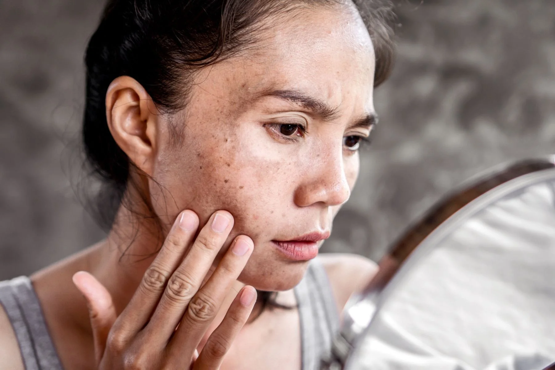 Skin TREATMENTS, MANKATO, MN