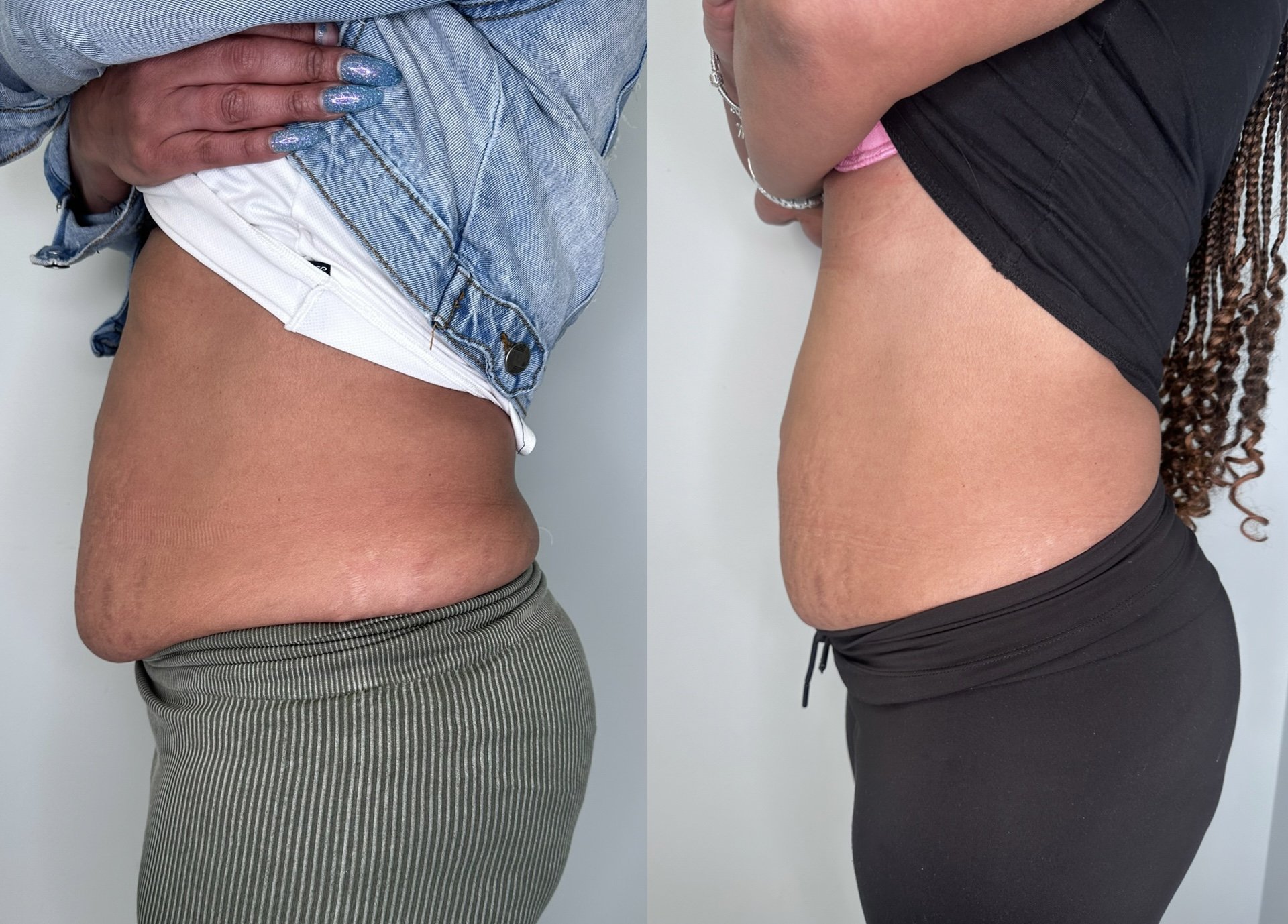 Side-by-side comparison photo of a woman before and after skincare or makeup treatment, with clear skin and a confident expression.