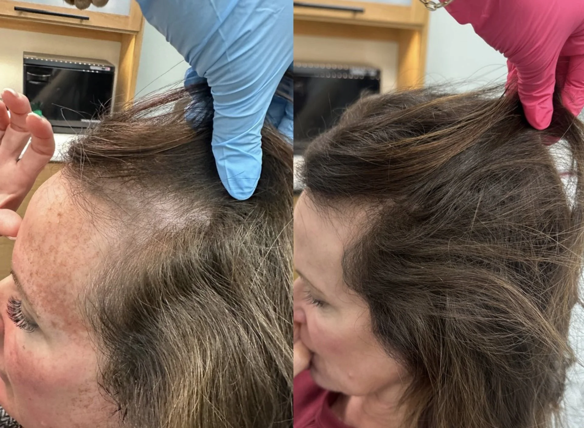 HAIR RESTORATION 1