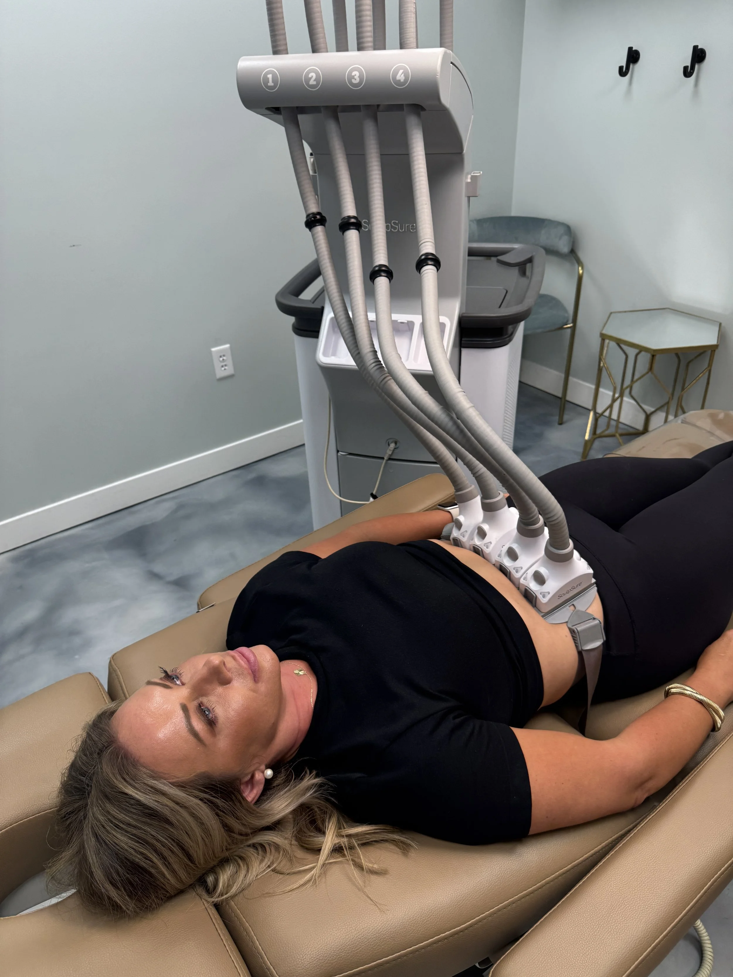 A woman lying on a medical recliner undergoing a procedure with multiple vacuum-assisted suction cups on her abdomen, connected to tubes.