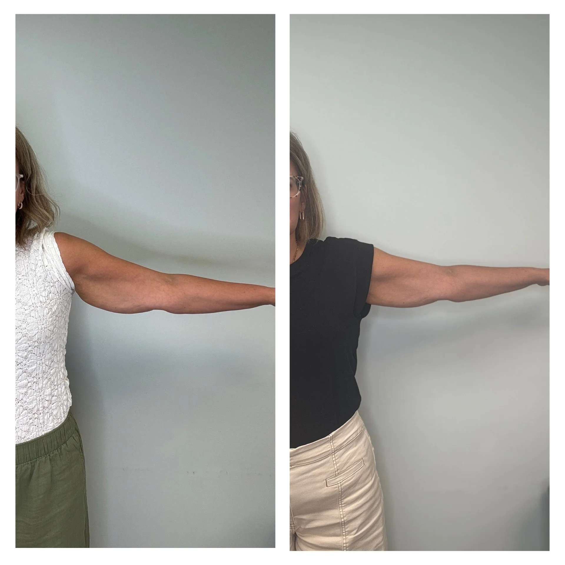 Side-by-side comparison of two people extending their arms forward, with the left person wearing a white lace top and olive green pants, and the right person wearing a black T-shirt and beige pants, against a plain light blue wall.