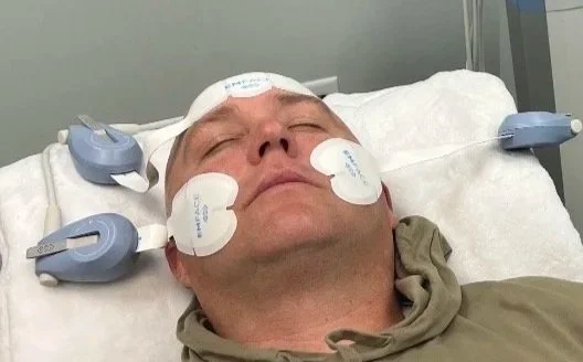 Man in hospital bed with medical electrodes on face and head, appearing unconscious or sedated.