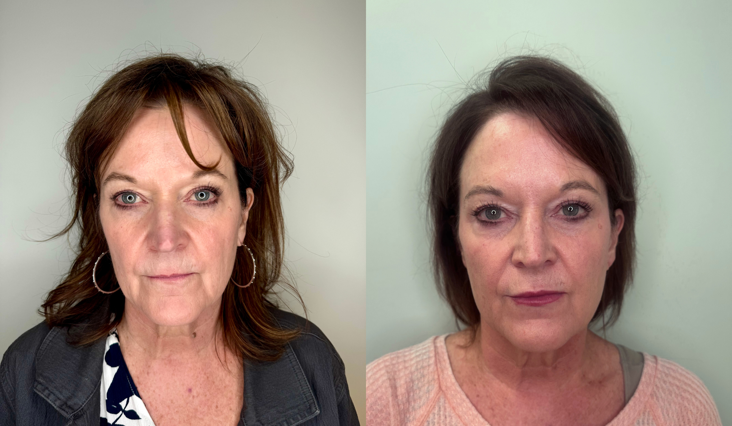 Side-by-side comparison of two women with shoulder-length brown hair, fair skin, and blue eyes, against plain light-colored backgrounds.
