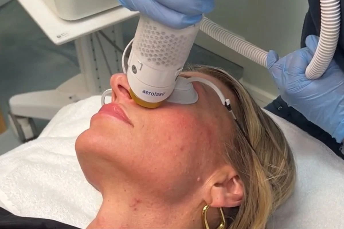 A woman receiving a facial treatment with a specialized laser device on her face, lying on a treatment bed. The healthcare professional is wearing gloves and holding the device.
