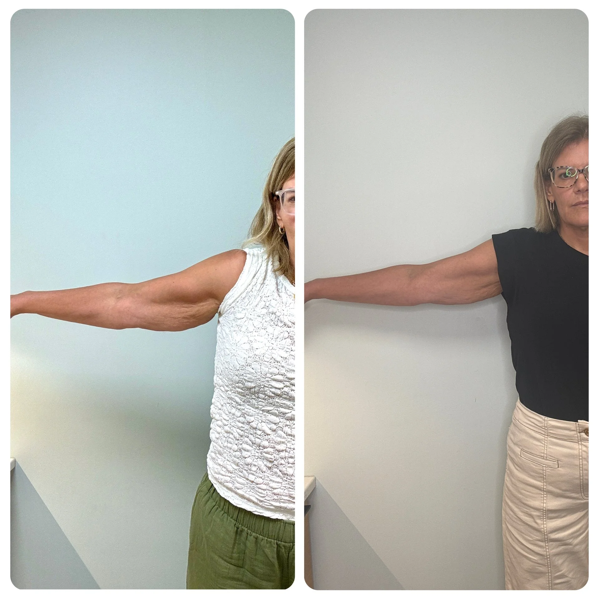 Comparison of two women showing their outstretched arms in front of a plain white wall, one wearing a white sleeveless top and the other wearing a black t-shirt.