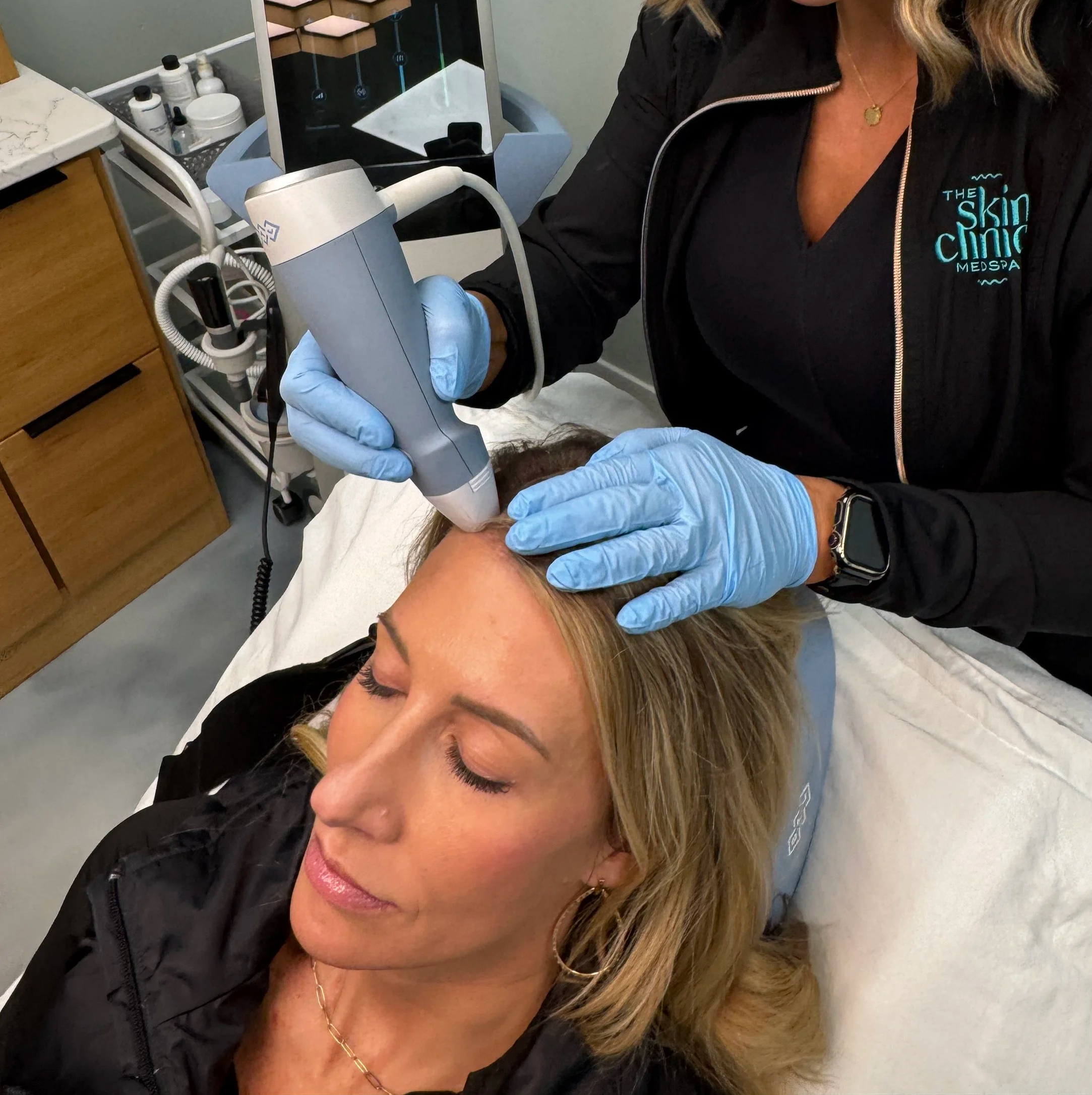 Hair REstoration treatment with Exion at the Skin CLinic 