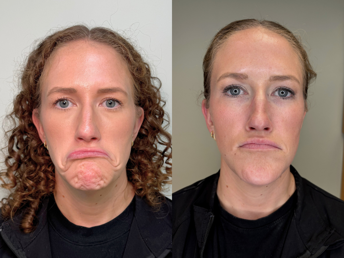 Side-by-side comparison of two women, both with red hair and wearing black shirts, showing different facial expressions; the woman on the left looks sad or disappointed with a downward-turned mouth, and the woman on the right looks serious or contemplative with a neutral expression.