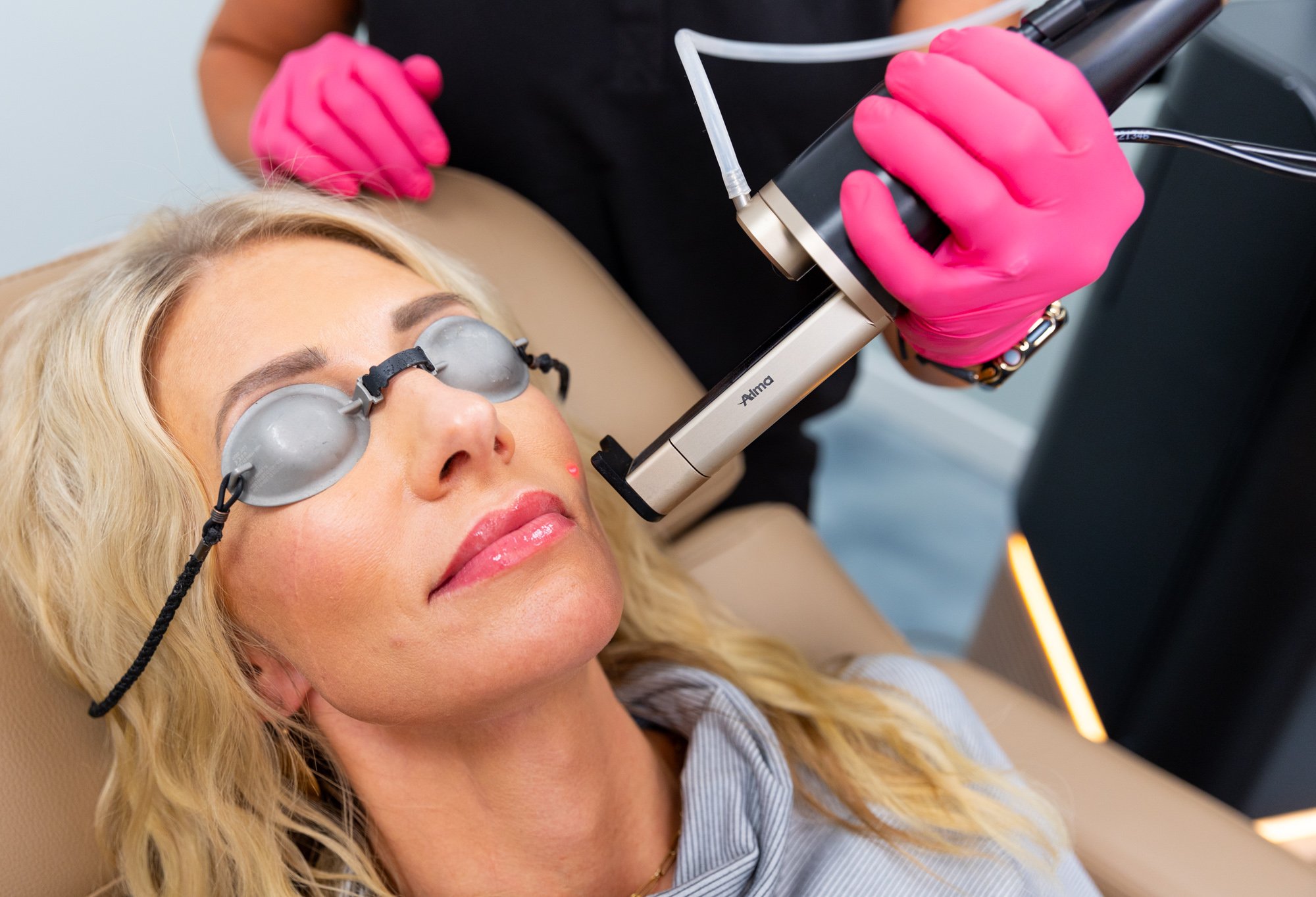 A woman lying on a treatment chair during a cosmetic procedure with protective glasses. A practitioner, wearing a black uniform and pink gloves, is holding a device above her face.