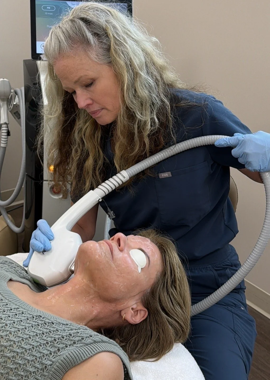 IPL Photofacial