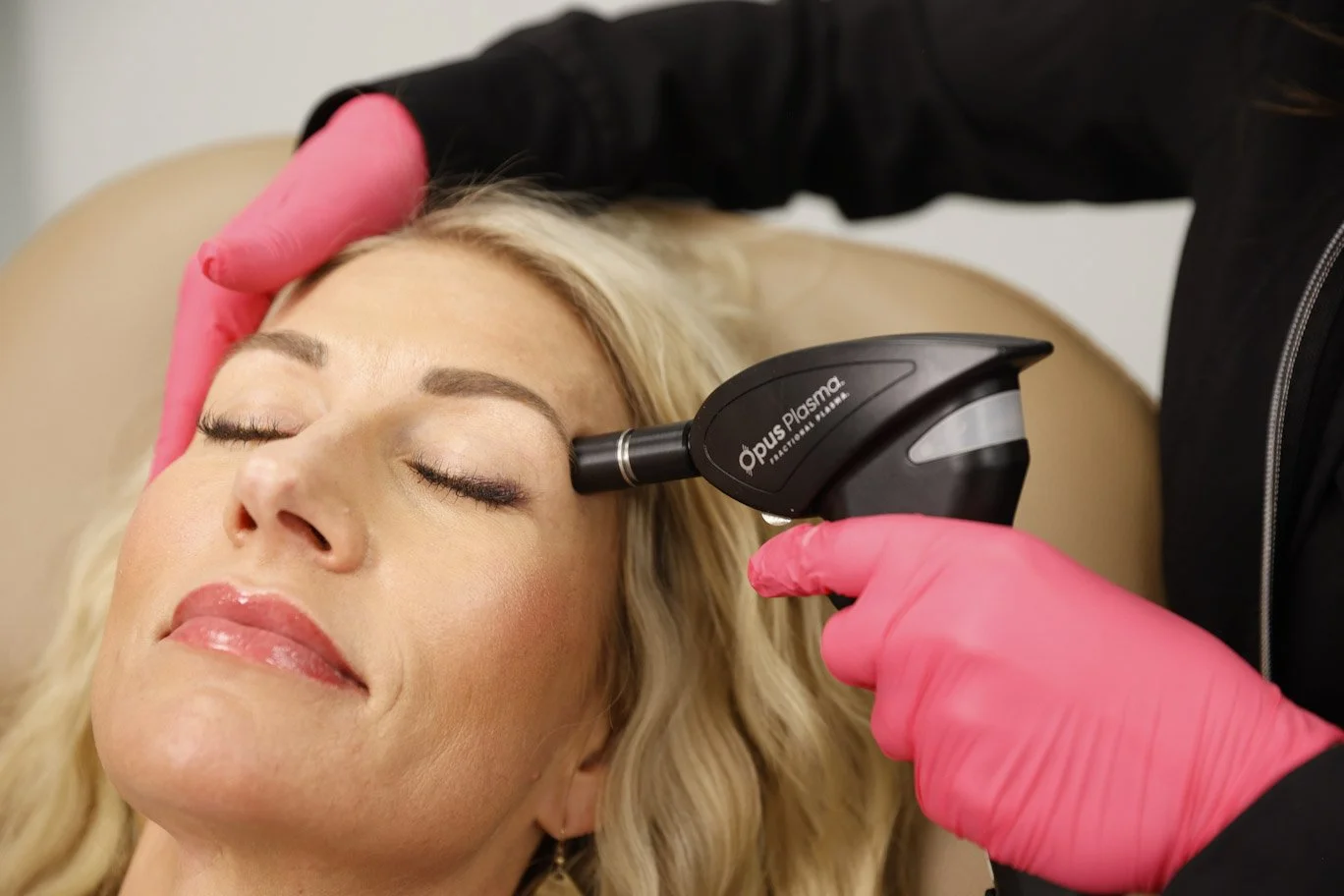 A woman receiving a cosmetic treatment with an Opus Plasma device on her face, lying back with eyes closed while a professional in pink gloves operates the machine.