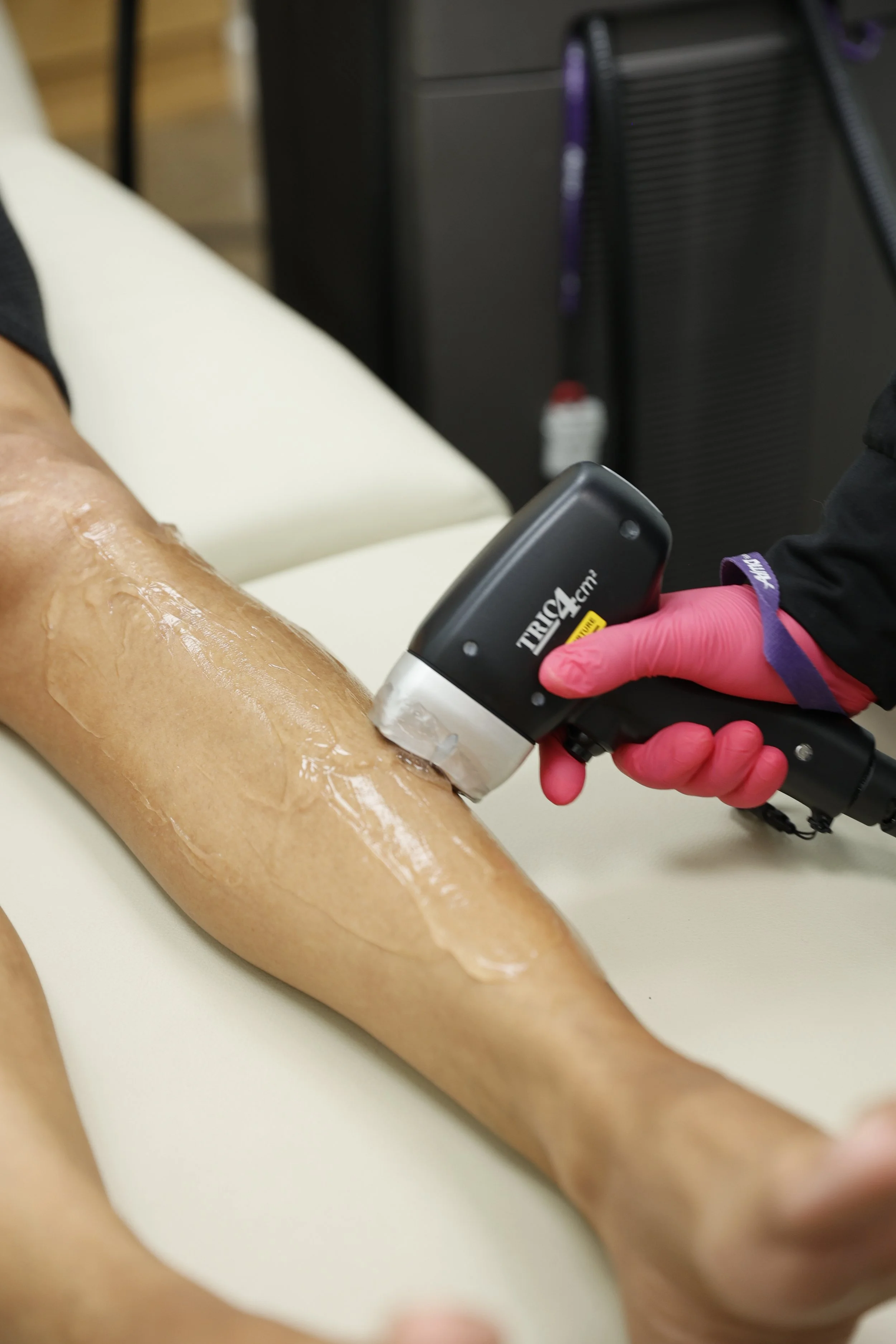 A person wearing pink gloves uses a handheld medical device on a person's arm, which appears to be undergoing a treatment or test; the arm is covered in a white substance, possibly gel.