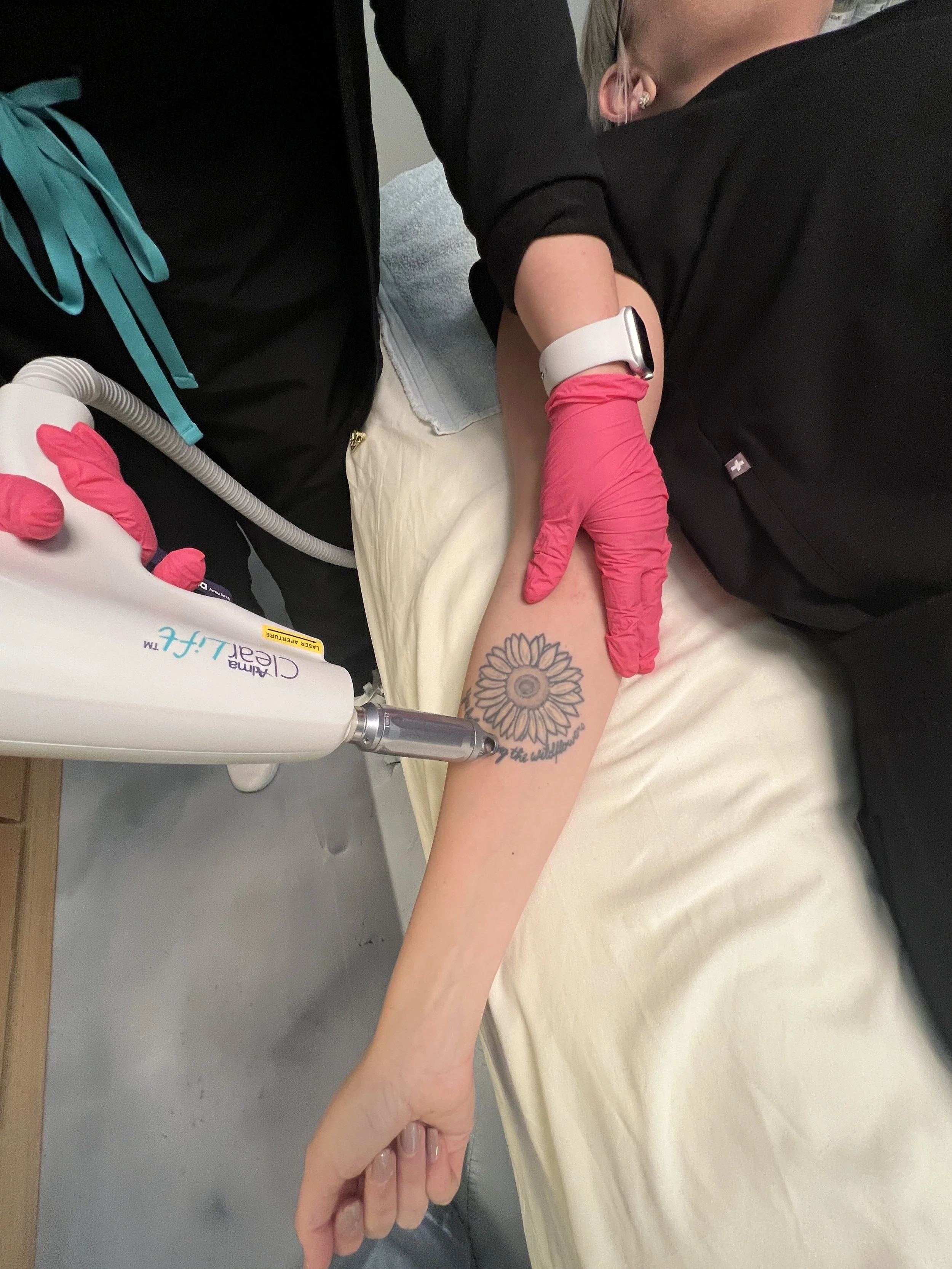 Person receiving a tattoo on their arm from a tattoo artist using a laser tattoo removal device.
