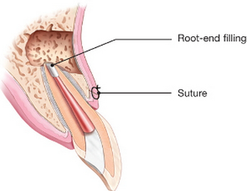 Microsurgery
