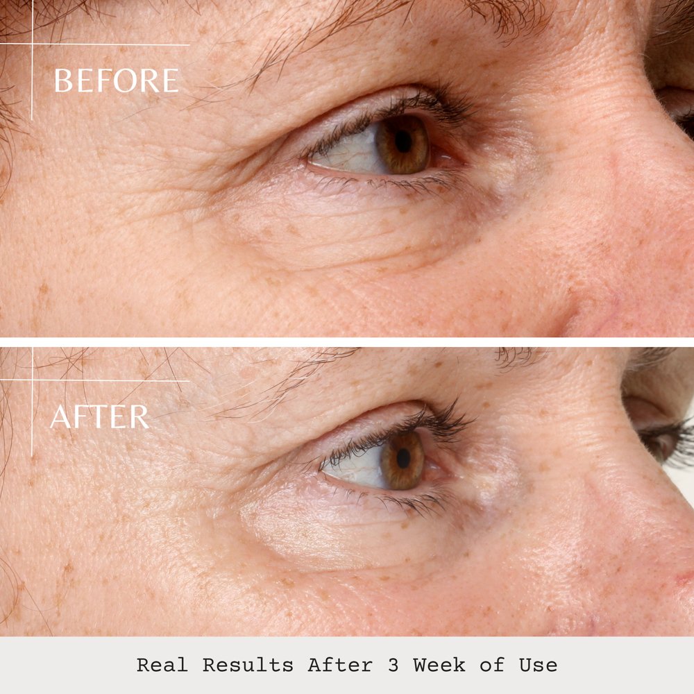 Opti Crystal-BAs-3 Week Side-1000x1000-72dpi.jpeg