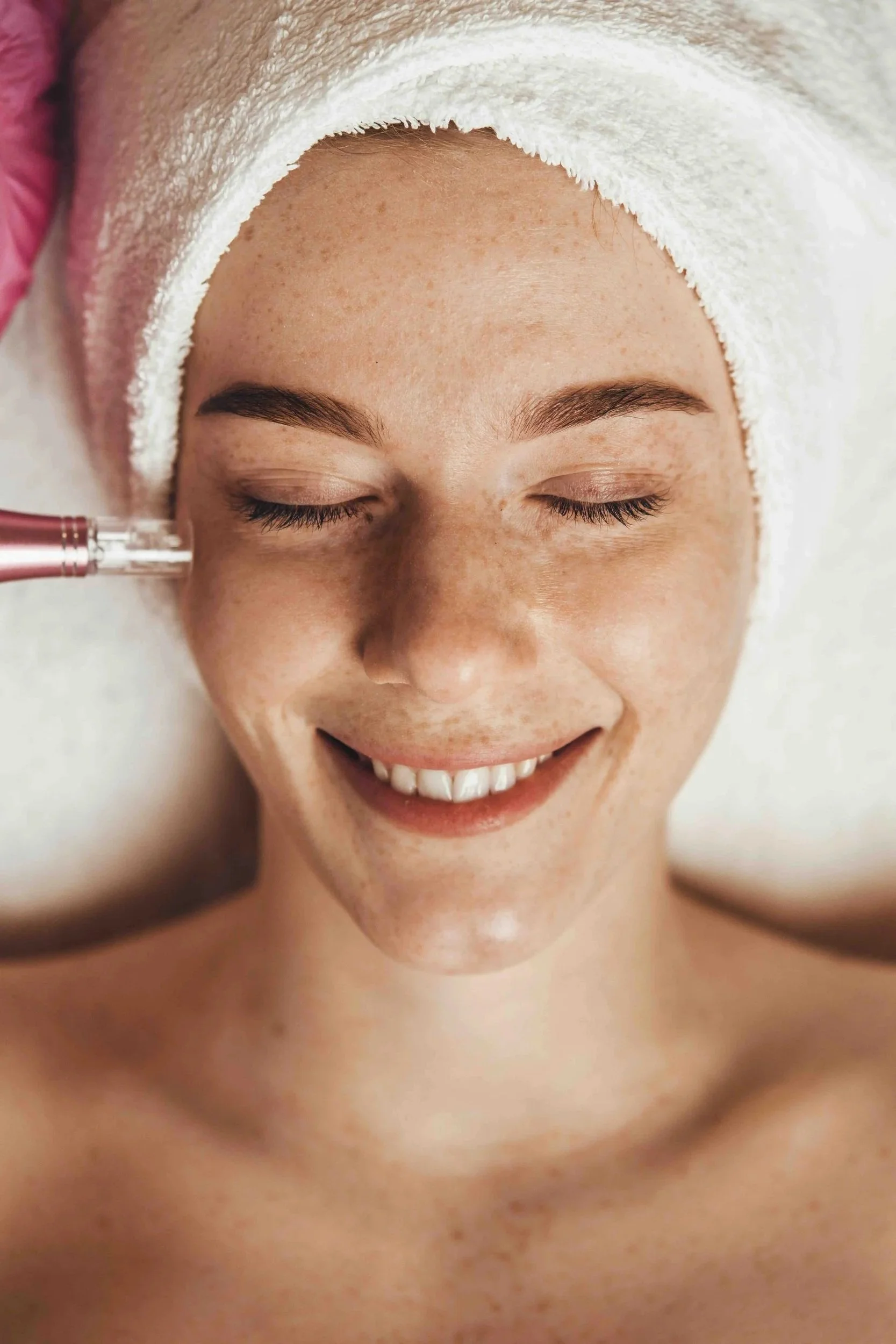 woman getting microneedling; skincare clinic colorado springs