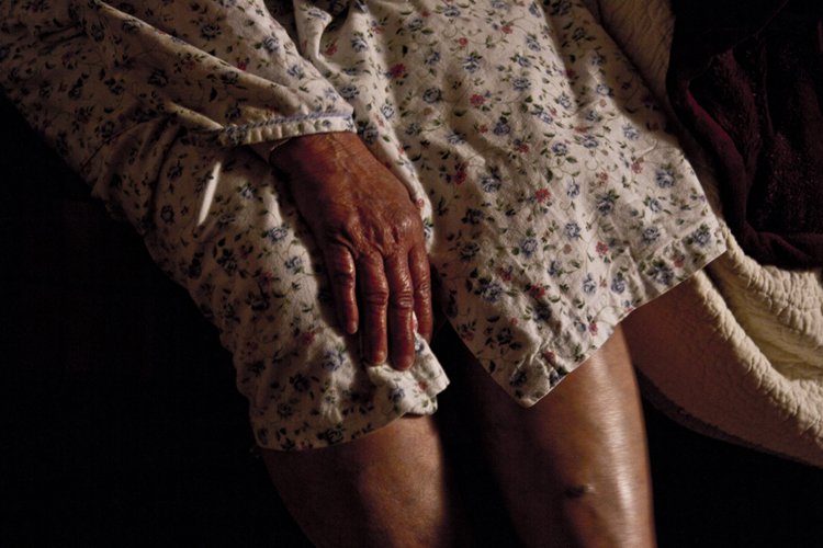 Close-up of an elderly person's hand resting on their lap, wearing a floral hospital gown.