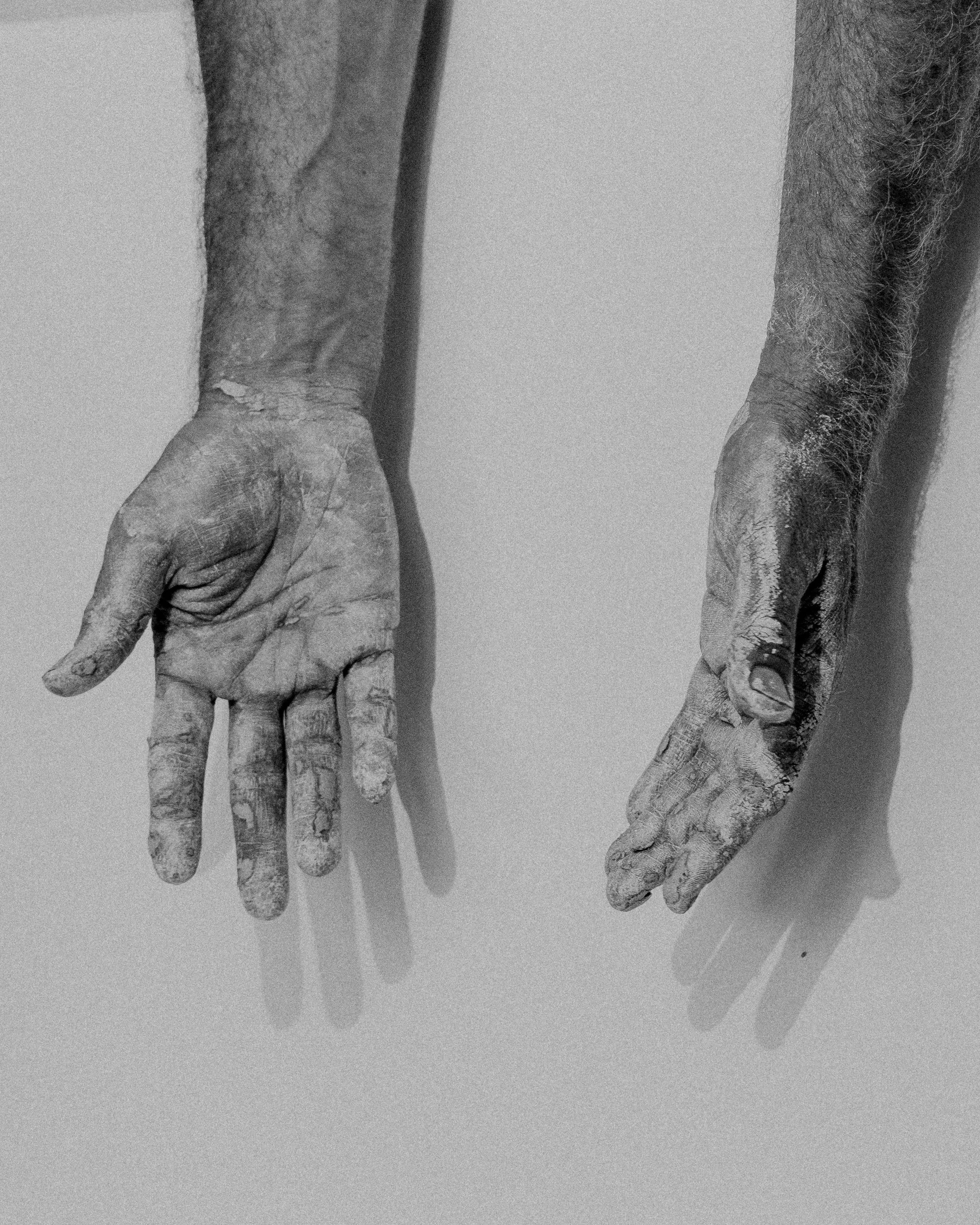 Pazzalotti Hands In Ceramic Clay