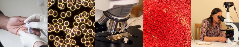 live blood analysis training