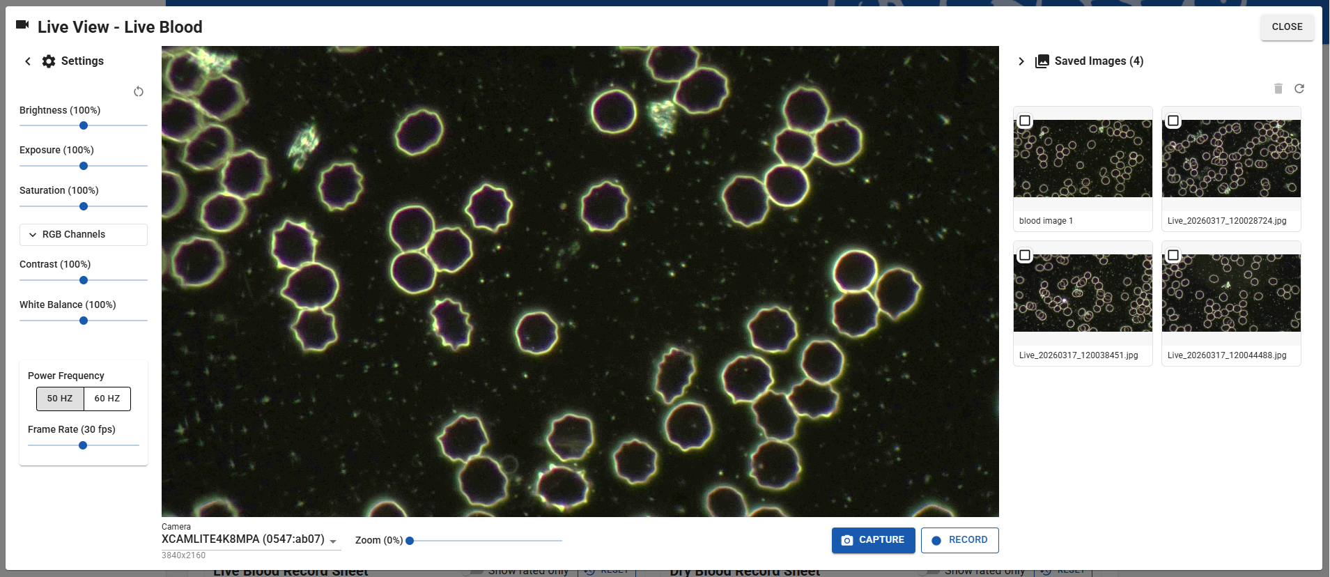 AnalystAssist Live View panel