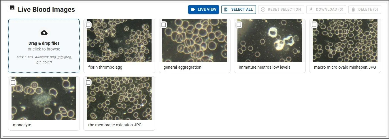 Appointment images panel - live blood