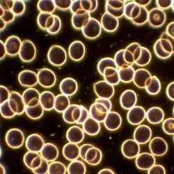 live blood analysis sample