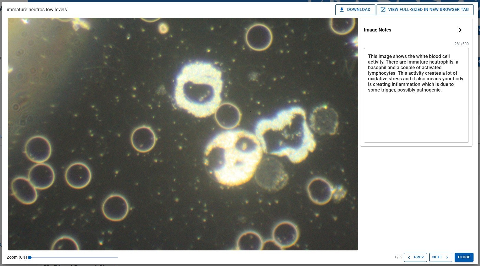 image preview window