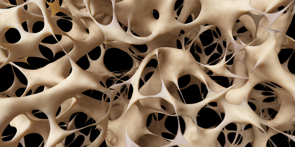 Why Bone Density Matters