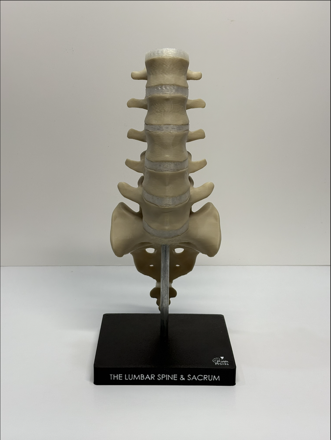 Lumbar Spine & Sacrum