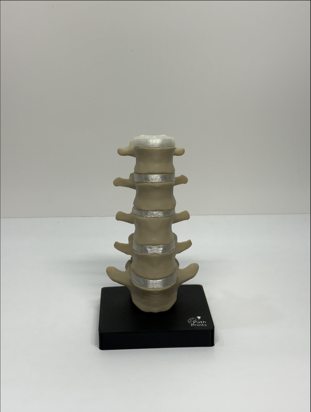 Modular Lumbar Spine