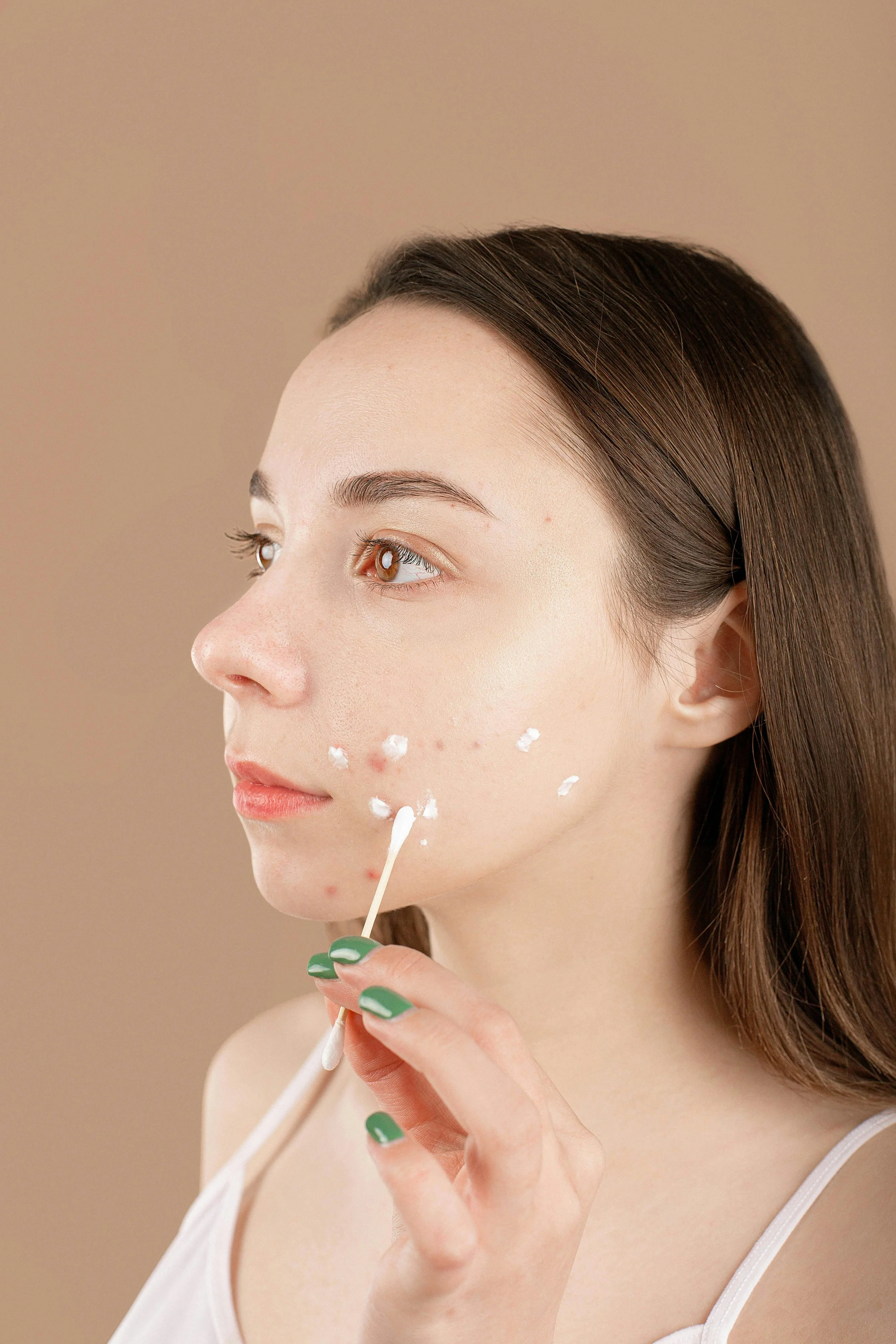 Acne Facial