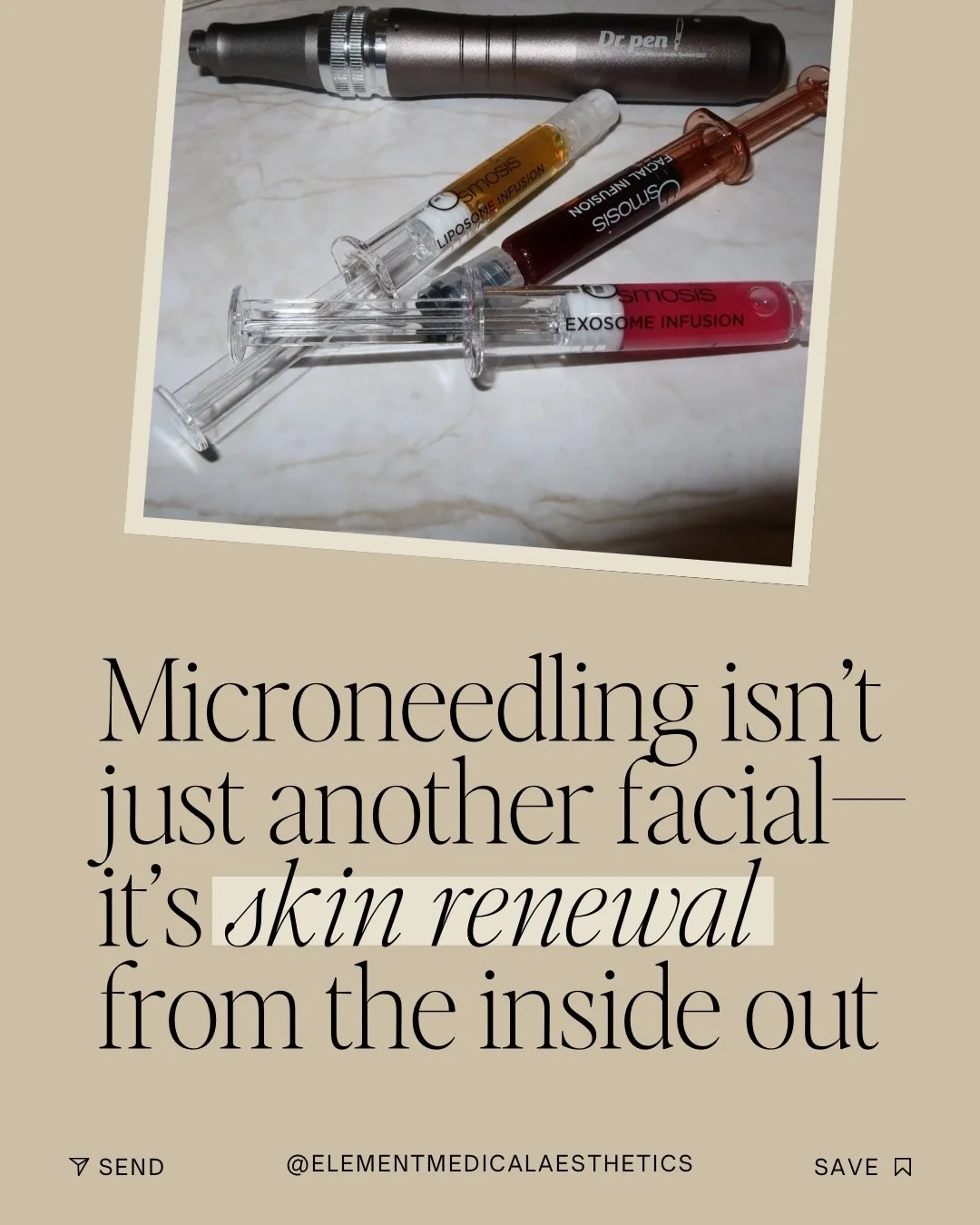 If you&rsquo;re in the McKinney / Frisco area and dealing with:
&bull; Fine lines
&bull; Acne scars
&bull; Large pores
&bull; Crepey under-eyes
&bull; Early skin laxity
&bull; Dull texture

Microneedling helps your skin rebuild itself from the inside